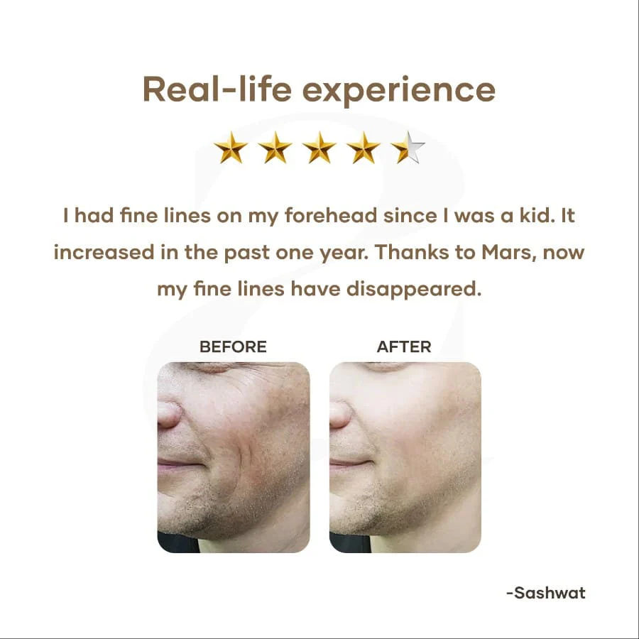 Anti Aging Serum with Retinol - Image 6