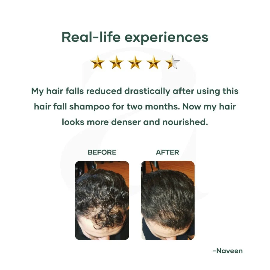 Anti Hairfall Shampoo for Men | SLS Free | Paraben Free - Image 5