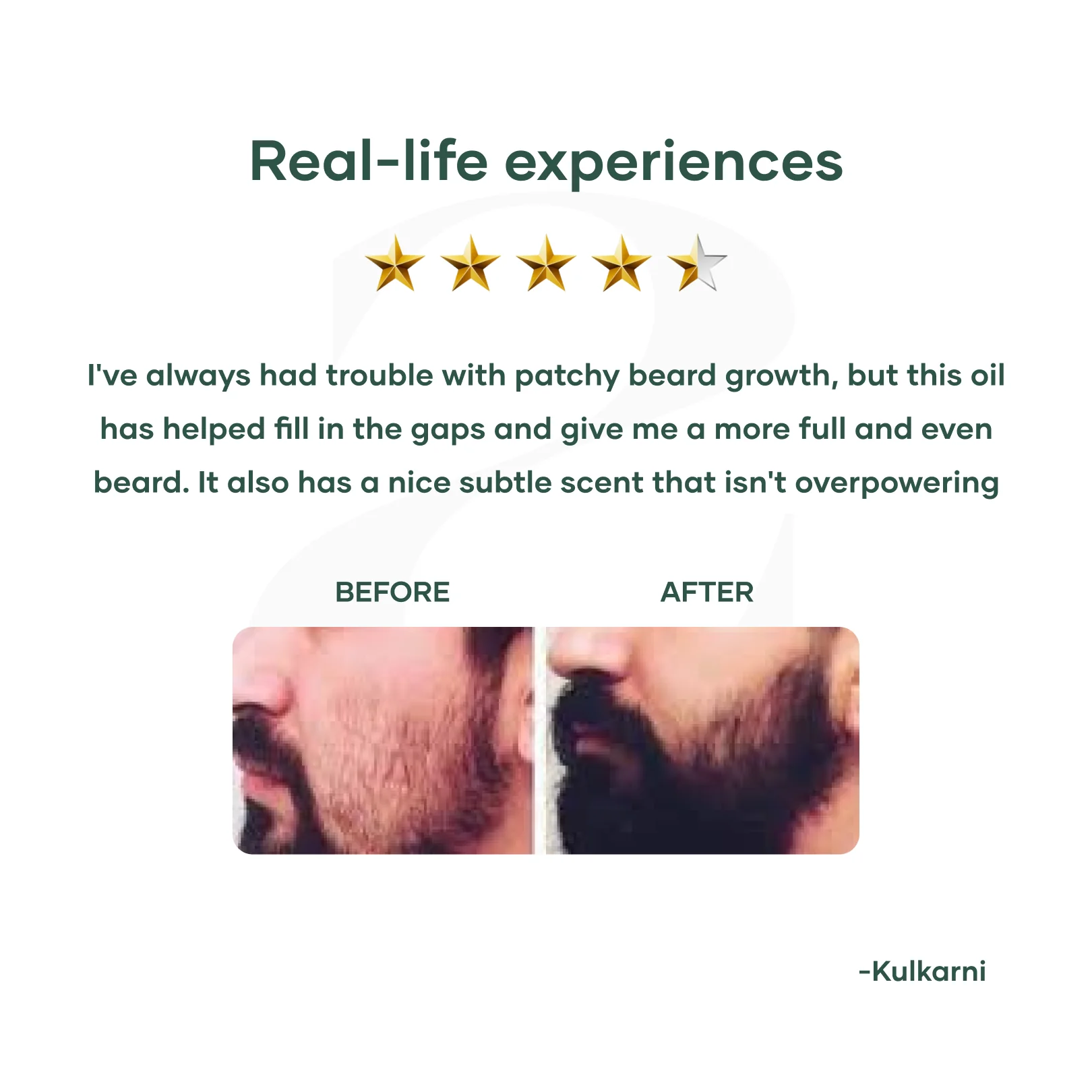 Beard Growth Oil for Smooth Beard - Image 6