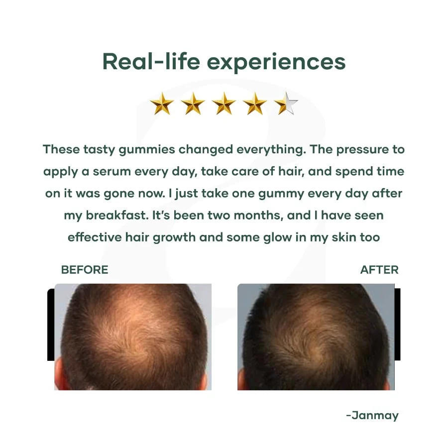 Biotin Gummies for Hair with Zinc - Image 6