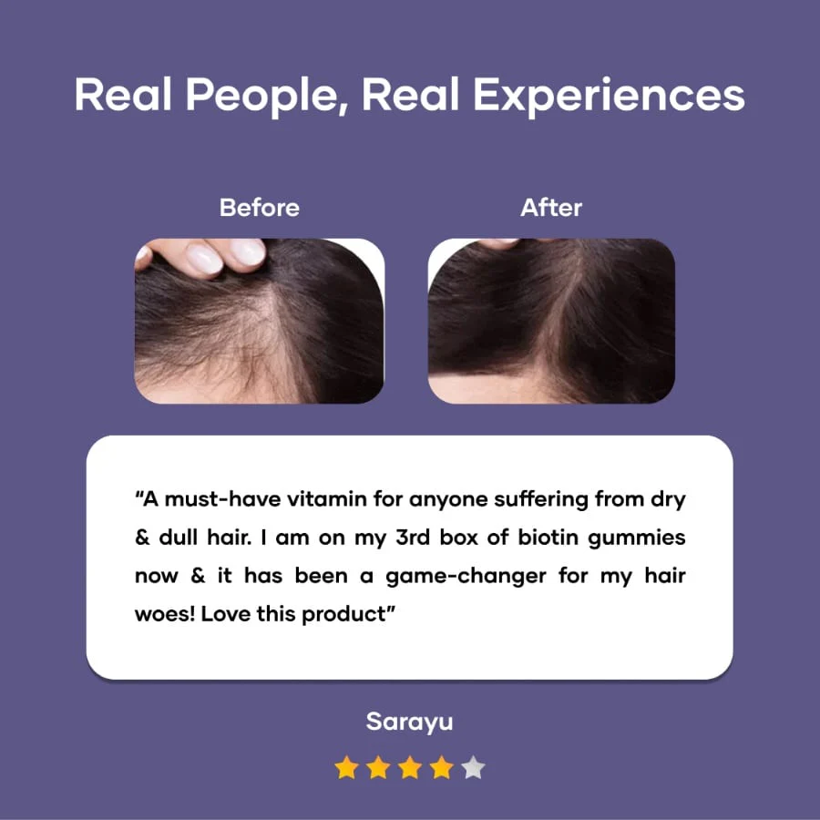 Biotin Gummies for Hair, Skin & Nails (30N) - Image 5
