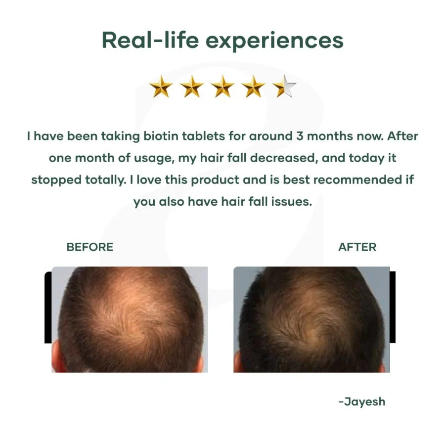Biotin Tablets for hair growth with Vitamin B7 - Image 6