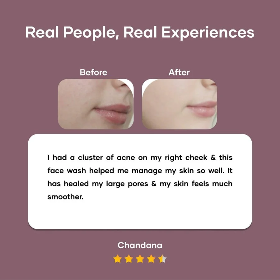 Foaming Face Wash with Tea Tree Oil - Image 6