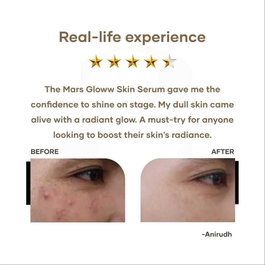 Gloww Skin Serum with Vitamin C & Niacinamide - Image 6