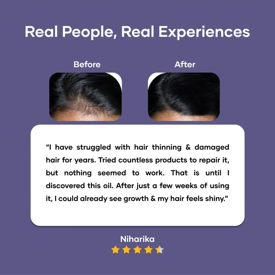 Onion Hair Oil with Bhringraj & Tea Tree Extracts - Image 6