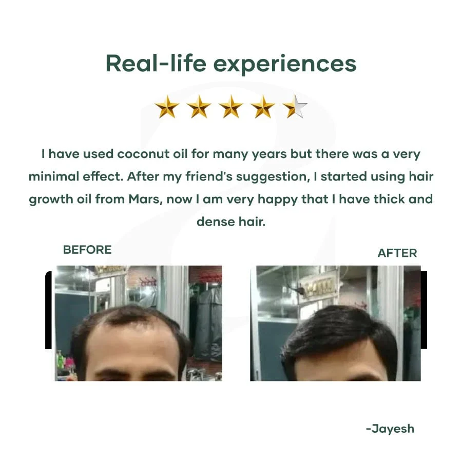 Hair Oil with Onion & Bhringraj Extracts - Image 6