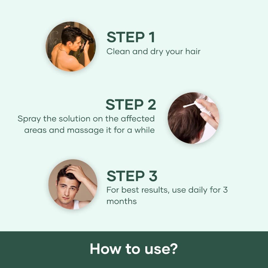 Minoxidil Fin. Topical Solution for Hair Growth - Image 4