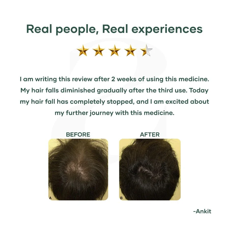 Hair Regrowth Tabs - Image 6