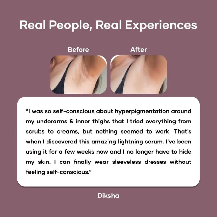 Intimate Lightening Serum for Underarms, Thighs, Elbows, Back & Bum - Image 6