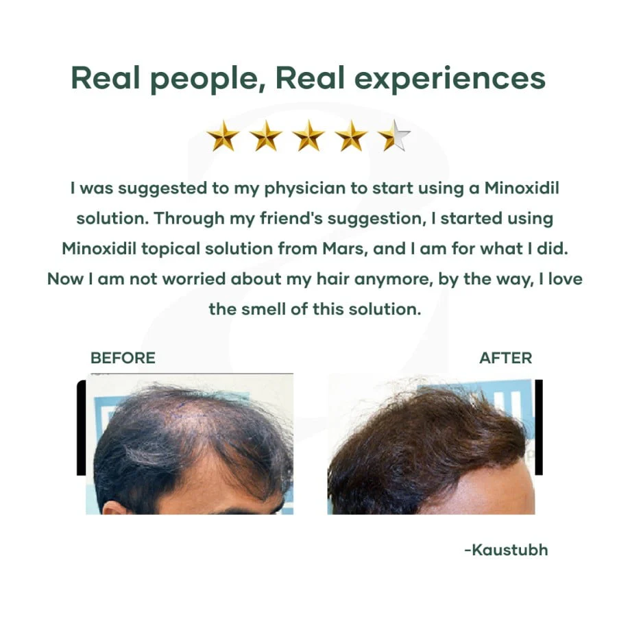 Minoxidil 5% Topical Solution for Men (60 ml) - Image 6