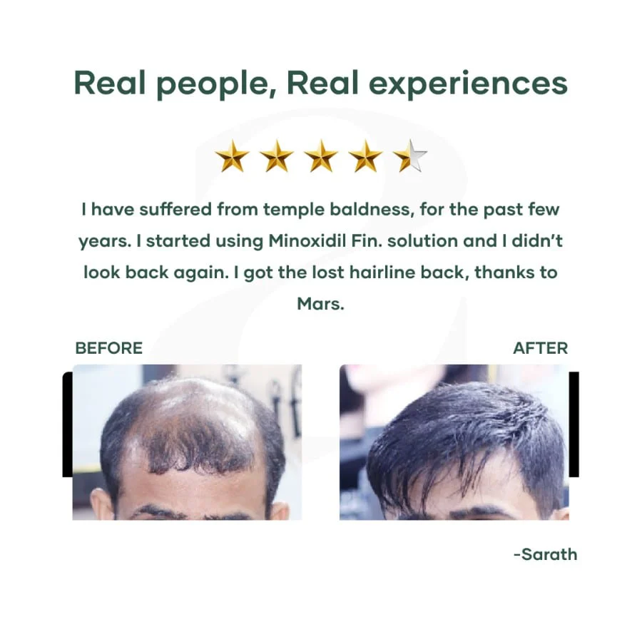 Minoxidil Fin. Topical Solution for Hair Growth - Image 6