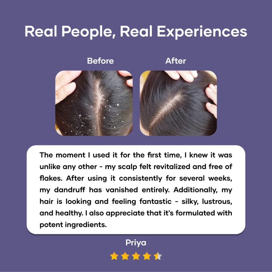 Saturn Anti-Dandruff Shampoo With Tea Tree Essence & Ginger Oil - Image 6