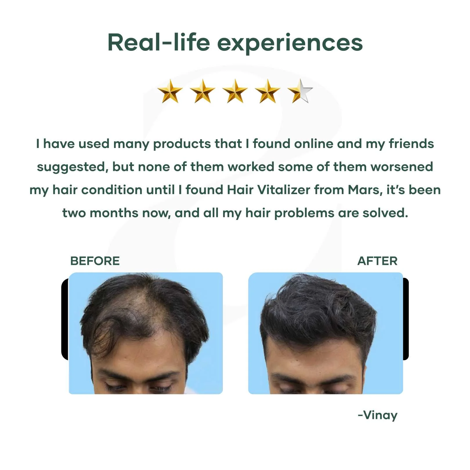 Hair Vitalizer with 1% Redensyl - Image 5